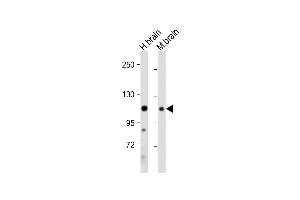 All lanes : Anti-EphA4 Antibody (C-term) at 1:2000 dilution Lane 1: Human brain tissue lysate Lane 2: Mouse brain tissue lysate Lysates/proteins at 20 μg per lane. (EPH Receptor A4 Antikörper  (C-Term))