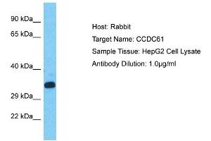 Host: Rabbit Target Name: CCDC61 Sample Type: HepG2 Whole Cell lysates Antibody Dilution: 1.