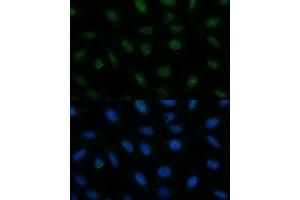 Immunofluorescence analysis of U-2 OS cells using CENPA Polyclonal Antibody (ABIN7266271) at dilution of 1:100 (40x lens). (CENPA Antikörper  (AA 1-100))