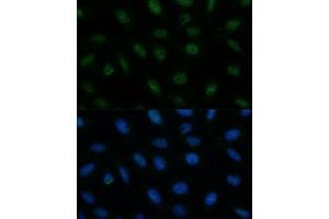 Immunofluorescence analysis of U-2 OS cells using CENPA Polyclonal Antibody (ABIN7266271) at dilution of 1:100 (40x lens). (CENPA Antikörper  (AA 1-100))