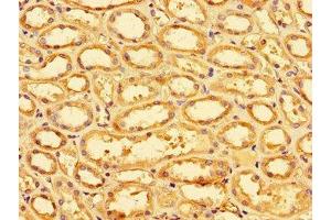 Immunohistochemistry of paraffin-embedded human kidney tissue using ABIN7170023 at dilution of 1:100