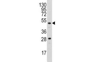 Western blot analysis of Urokinase antibody and A2058 lysate (PLAU Antikörper  (AA 60-90))