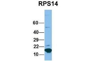 Host:  Rabbit  Target Name:  RPS14  Sample Type:  Hela  Antibody Dilution:  1. (RPS14 Antikörper  (Middle Region))