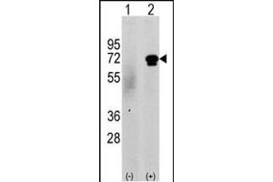 Western blot analysis of CKK2 (arrow) using rabbit polyclonal CKK2 Antibody (N-term G67) (ABIN391182 and ABIN2841279). (CAMKK2 Antikörper  (N-Term))