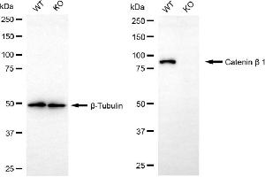 Western blotting analysis using catenin beta 1 antibody (ABIN7797932).