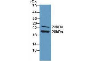 Detection of Recombinant FGF2, Mouse using Polyclonal Antibody to Fibroblast Growth Factor 2, Basic (FGF2) (FGF2 Antikörper  (AA 10-154))