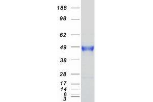 Validation with Western Blot (CA12 Protein (Transcript Variant 1) (Myc-DYKDDDDK Tag))