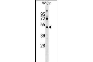 SUPT7L Antibody (Center) (ABIN1537989 and ABIN2848712) western blot analysis in WiDr cell line lysates (35 μg/lane).
