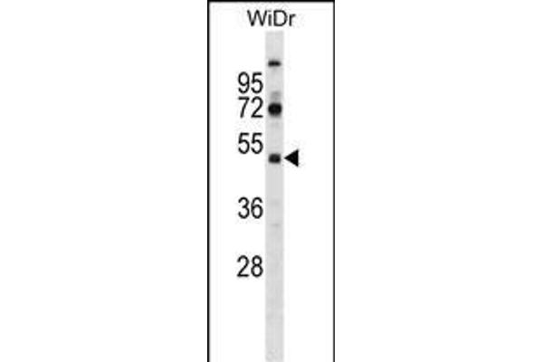 SUPT7L Antikörper  (AA 186-214)