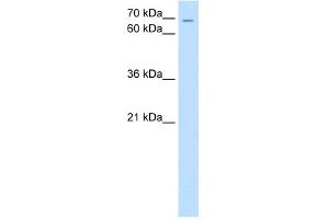 WB Suggested Anti-ZNF131 Antibody Titration:  0. (ZNF131 Antikörper  (N-Term))