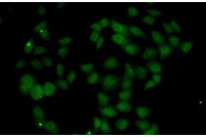 Immunofluorescence analysis of U2OS cells using FGF14 Polyclonal Antibody (FGF14 Antikörper)