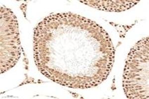 Immunohistochemistry analysis of paraffin-embedded mouse testis using,MCM4 (ABIN7074631) at dilution of 1: 2400 (MCM4 Antikörper)