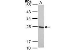 Image no. 1 for anti-Peroxiredoxin 1 (PRDX1) (AA 19-116) antibody (ABIN467365) (Peroxiredoxin 1 Antikörper  (AA 19-116))