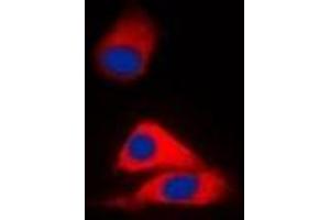 Immunofluorescent analysis of MVK staining in HepG2 cells.