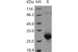 Western Blotting (WB) image for Triggering Receptor Expressed On Myeloid Cells 4 (TREM4) protein (His tag) (ABIN7321089)