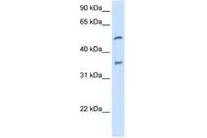 Image no. 2 for anti-Cytochrome P450, Family 2, Subfamily D, Polypeptide 6 (CYP2D6) (AA 101-150) antibody (ABIN204973)