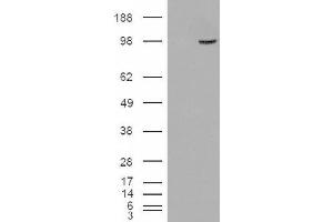 Image no. 2 for anti-Serine/threonine-Protein Phosphatase 4 Regulatory Subunit 3A (SMEK1) (Internal Region) antibody (ABIN375112) (SMEK1 Antikörper  (Internal Region))