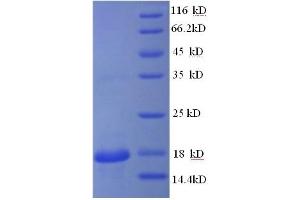 Hemoglobin, beta Adult Minor Chain (HBB-B2) (AA 2-147) protein (GST tag)