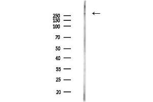 anti-Filamin B, beta (FLNB) (Internal Region) antibody
