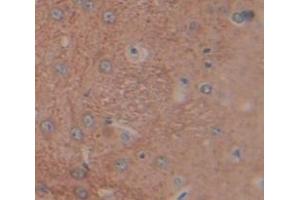 Used in DAB staining on fromalin fixed paraffin- embedded Kidney tissue (LCNL1 Antikörper  (AA 2-164))