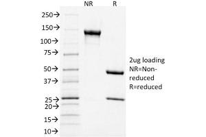 SDS-PAGE (SDS) image for anti-CD3 epsilon (CD3E) (AA 23-119) antibody (ABIN6941022)