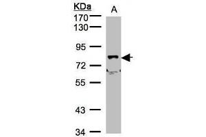WB Image Sample(30 μg of whole cell lysate) A:A431, B:H1299 7. (SHKBP1 Antikörper)