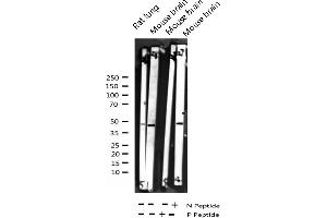 Western blot analysis of Phospho-p38 MAPK (Tyr182) expression in various lysates