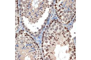 Immunohistochemistry of paraffin-embedded mouse testis using eIF3e Rabbit mAb (ABIN7267040) at dilution of 1:100 (40x lens).