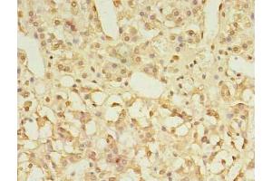 Immunohistochemistry of paraffin-embedded human adrenal gland tissue using ABIN7153339 at dilution of 1:100 (GPR3 Antikörper  (AA 300-330))