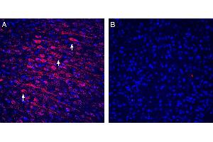 Expression of Tetraspanin-3 in rat cortex.