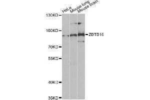 Western blot analysis of extracts of various cell lines, using ZBTB16 Antibody (ABIN5973474) at 1/1000 dilution. (ZBTB16 Antikörper)