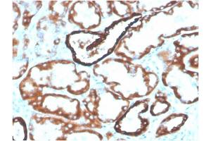 Formalin-fixed, paraffin-embedded human kidney stained with Biotin-conjugated CDH16Mouse Monoclonal Antibody (CDH16/2125). (Cadherin-16 Antikörper  (AA 371-507) (Biotin))