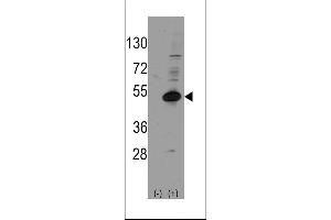 Western blot analysis of NROB1 (arrow) using rabbit polyclonal NROB1 Antibody (Human C-term) (ABIN389158 and ABIN2839324). (NR0B1 Antikörper  (C-Term))