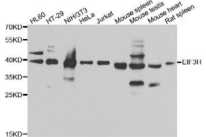Western blot analysis of extracts of various cell lines, using EIF3H antibody. (EIF3H Antikörper)