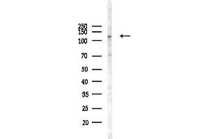 anti-StAR-Related Lipid Transfer (START) Domain Containing 13 (STARD13) (N-Term) antibody