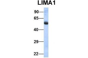 Host:  Rabbit  Target Name:  LIMA1  Sample Type:  Human Fetal Lung  Antibody Dilution:  1. (LIMA1 Antikörper  (N-Term))