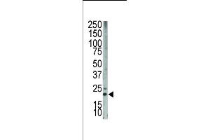 The anti-Bim BH3 domain Pab (ABIN388101 and ABIN2846193) is used in Western blot to detect Bim BH3 in HL-60 cell lysate. (BIM Antikörper  (AA 130-165))