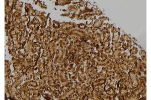ABIN6257373 and ABIN6274770 at 1/100 staining Rat kidney tissue by IHC-P. (RPL17 Antikörper  (C-Term))
