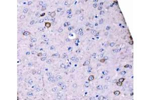 IHC analysis of SCRN1 using anti-SCRN1 antibody (ABIN7602923). (Secernin 1 Antikörper  (C-Term))