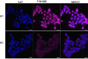 anti-Family with Sequence Similarity 98, Member B (FAM98B) antibody