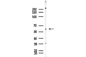 anti-Dihydroxyacetone Kinase 2 Homolog (DAK) (Internal Region) antibody