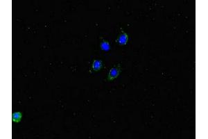 Immunofluorescent analysis of HepG2 cells using ABIN7150100 at dilution of 1:100 and Alexa Fluor 488-congugated AffiniPure Goat Anti-Rabbit IgG(H+L) (Dmx-Like 2 Antikörper  (AA 2471-2657))