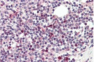 ABIN334506 (5µg/ml) staining of paraffin embedded Human Spleen. (TFEC Antikörper  (Internal Region))