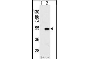 Western blot analysis of SYMD2 (arrow) using rabbit polyclonal SYMD2 Antibody (N-term) (ABIN387897 and ABIN2844146). (SMYD2A Antikörper  (N-Term))