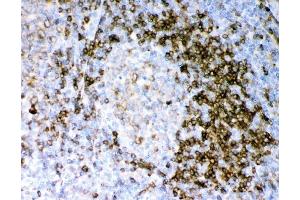 IHC analysis of CD79A using anti-CD79A antibody (ABIN3043397). (CD79a Antikörper  (AA 121-226))