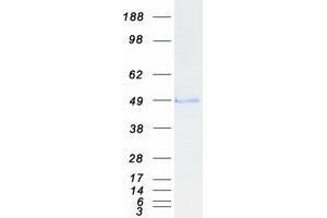 Validation with Western Blot