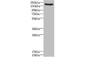 Western blot All lanes: LY75 antibody IgG at 1. (LY75/DEC-205 Antikörper  (AA 440-680))