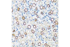 Immunohistochemistry of paraffin-embedded mouse kidney using  antibody (ABIN7265652) at dilution of 1:100 (40x lens). (AQP2 Antikörper  (AA 147-271))