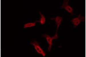 Immunofluorescence (fixed cells) (IF/ICC) image for anti-PTK2 Protein tyrosine Kinase 2 (PTK2) (pTyr397) antibody (ABIN6256730)