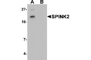 Western blot analysis of SPINK2 in mouse heart tissue lysate with SPINK2 antibody at 1 µg/mL in (A) the absence and (B) the presence of blocking peptide. (SPINK2 Antikörper  (C-Term))